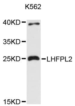 LHFPL2 Antibody