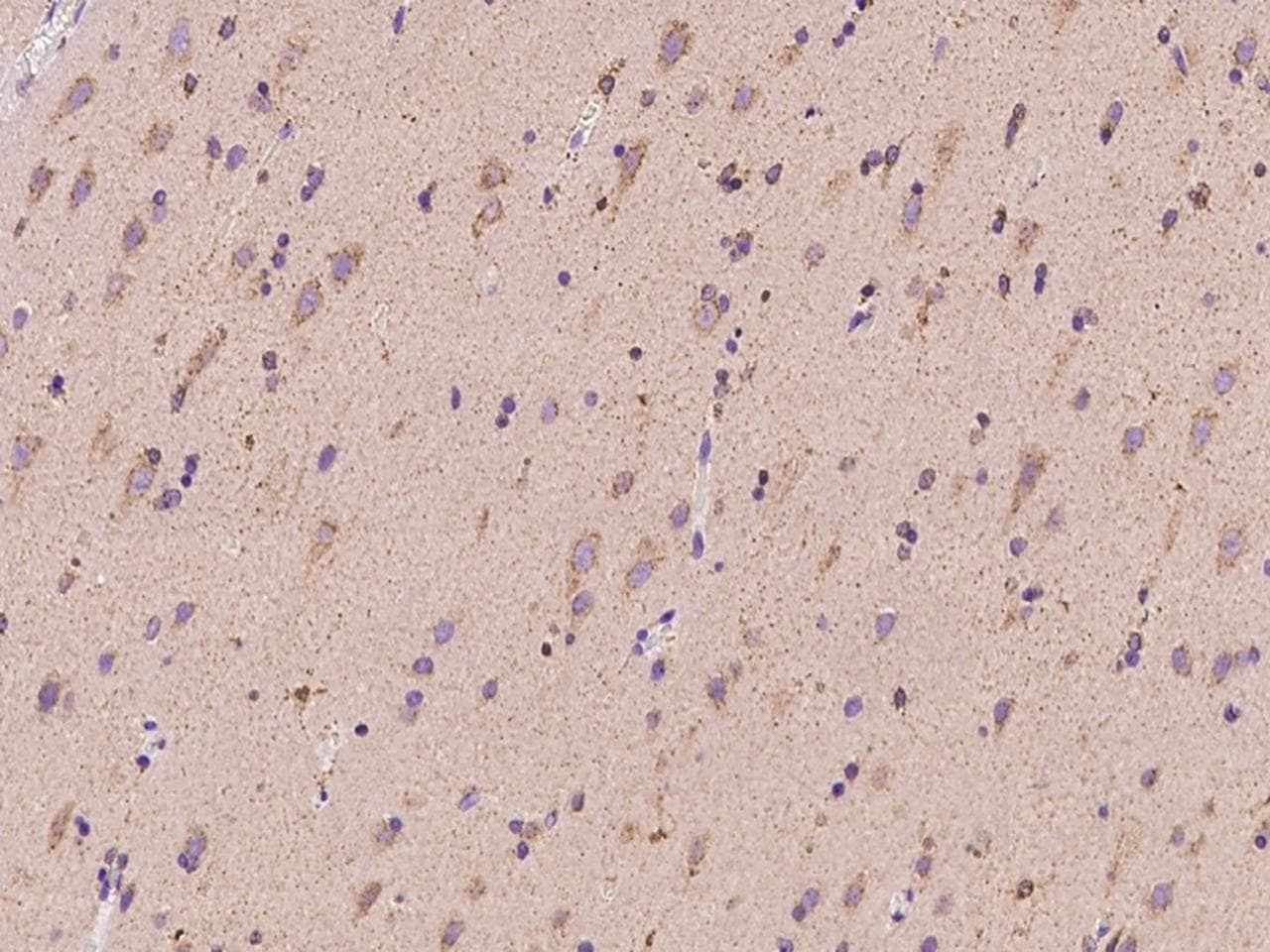Polyclonal Rabbit anti-Human SYT11 Antibody (IHC, WB)