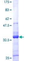 Human ATRX Protein (Recombinant GST)
