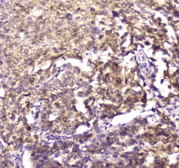 YWHAZ / 14-3-3 Zeta Antibody