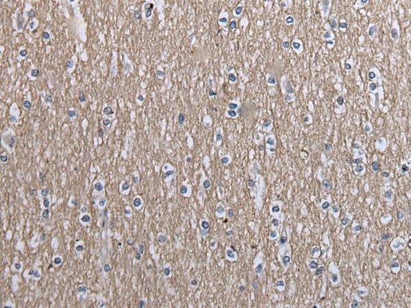 SLC39A14 / ZIP14 Antibody