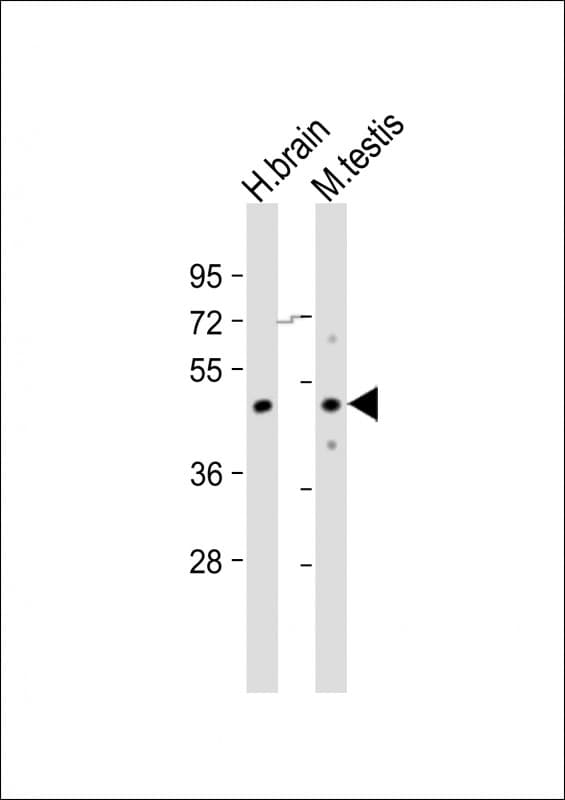 TGFB3 / TGF Beta3 Antibody (aa215-249)