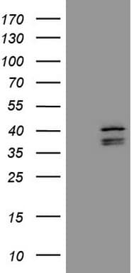 EBLN2 / FLJ10213 Antibody (clone OTI1A2)