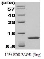 Human TGFBI Protein (Recombinant)