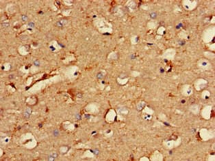 Polyclonal Rabbit anti-Human RCAN2 / RCN2 Antibody (IHC, IF, WB)