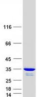 Human UCK2 Protein (Recombinant Myc-DDK (Flag))