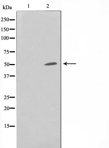 SPT3 / SUPT3H Antibody