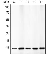 Polyclonal Rabbit anti-Human CDKN2B / p15 INK4b Antibody (C-Terminus, IHC, IF, WB)