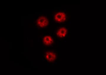 PIN1 Antibody (phospho-Ser16)