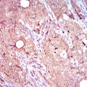 ITGB4 / Integrin Beta 4 Antibody (Amino Acid: 1619-1822, clone 10B10D5)