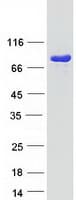 Human TGM2 / Transglutaminase 2 Protein (Recombinant Myc-DDK (Flag))