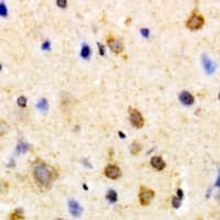 Polyclonal Rabbit anti-Human PSKH1 Antibody (Internal, IHC, WB)