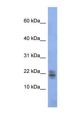 Ribonuclease A / RNASE1 Antibody (C-Terminus)