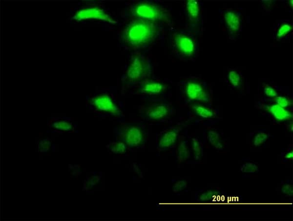 CLIC3 Antibody (clone 3F8)