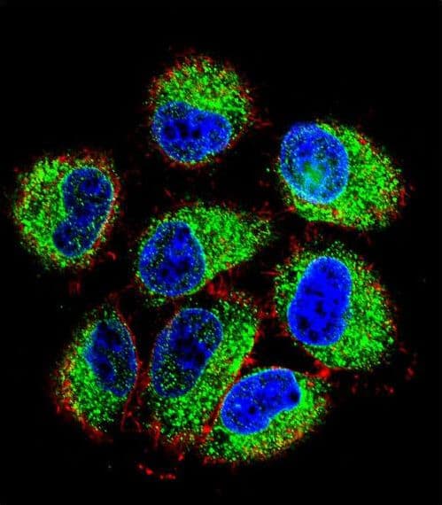 Polyclonal Rabbit anti-Human TBC1D13 Antibody (aa76-105, IHC, IF, WB)