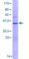Human RHBDL2 / RRP2 Protein (Recombinant GST)