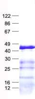 Human DHRS13 Protein (Recombinant His, N-Terminal)