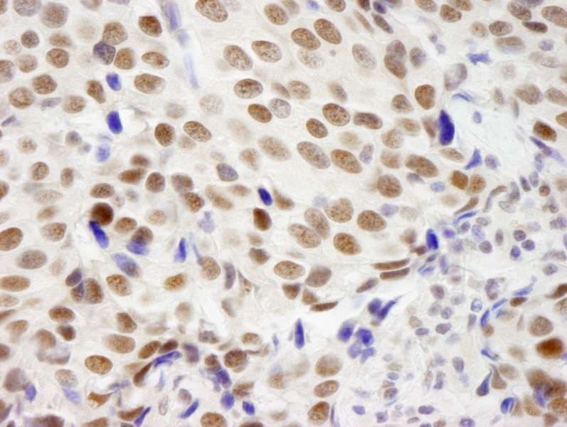 Polyclonal Rabbit anti-Human ZMYM3 Antibody (aa250-300, IHC)