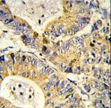 Polyclonal Rabbit anti-Human RPS18 / Ribosomal Protein S18 Antibody (aa62-91, IHC, WB)