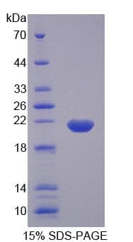 Human CPLX1 / Complexin 1 Protein (Recombinant)