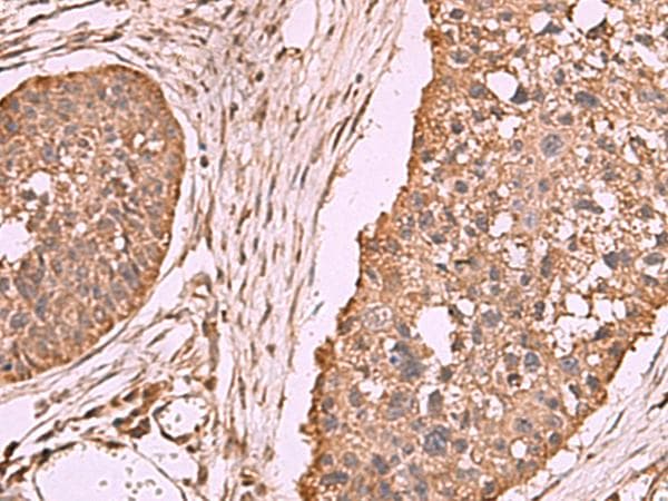 PER3 Antibody