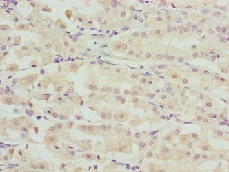Polyclonal Rabbit anti-Human RIBC2 Antibody (IHC, WB)