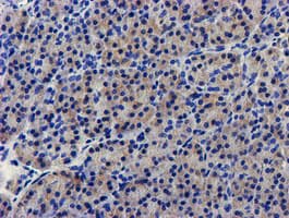 LPL / Lipoprotein Lipase Antibody (aa28-475, clone OTI6A10)