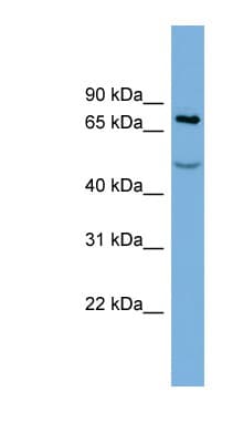 GOK / STIM1 Antibody (aa611-660)