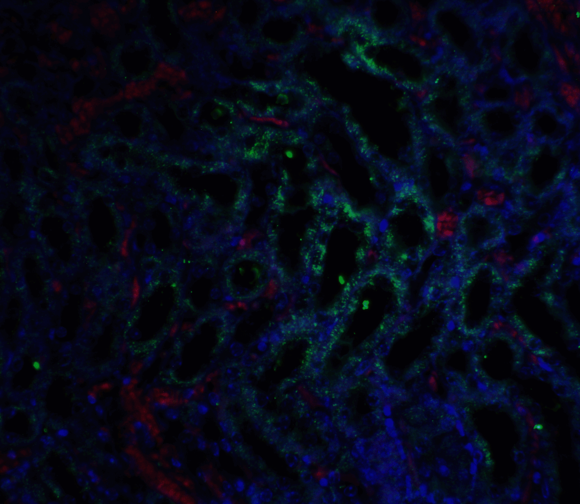 IHC-plus™ Polyclonal Rabbit anti-Human GFRA3 Antibody (IHC, IF, WB)