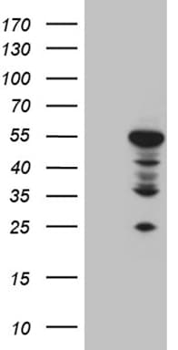 MOK / RAGE Antibody (aa205-419, clone OTI6C12)