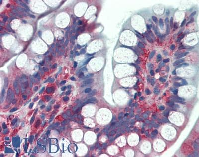 IHC-plus™ TFG Antibody (aa125-175)
