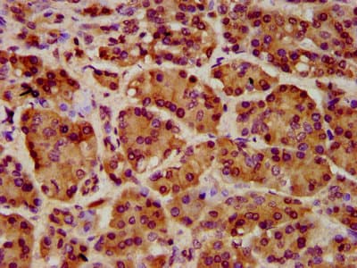 ART5 Antibody
