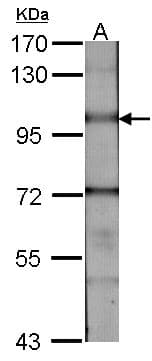 BMPR2 Antibody (aa667-951)