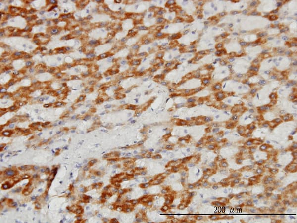 TIMM8A Antibody (clone 2F11)