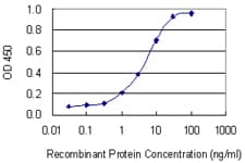 ITPKB Antibody (clone 2F8)