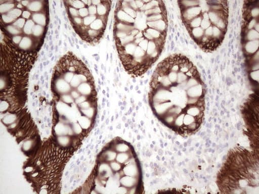 KRT16 / CK16 / Cytokeratin 16 Antibody (clone OTI2H8)