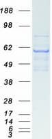 Human THRA / THR Alpha Protein (Recombinant Myc-DDK (Flag))