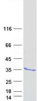 Human SOCS3 Protein (Recombinant Myc-DDK (Flag))