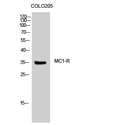 Polyclonal Rabbit anti-Human MC1R Antibody (240-320 aa, C-terminal, IF, WB)