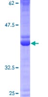 Human CRB3 Protein (Recombinant GST)