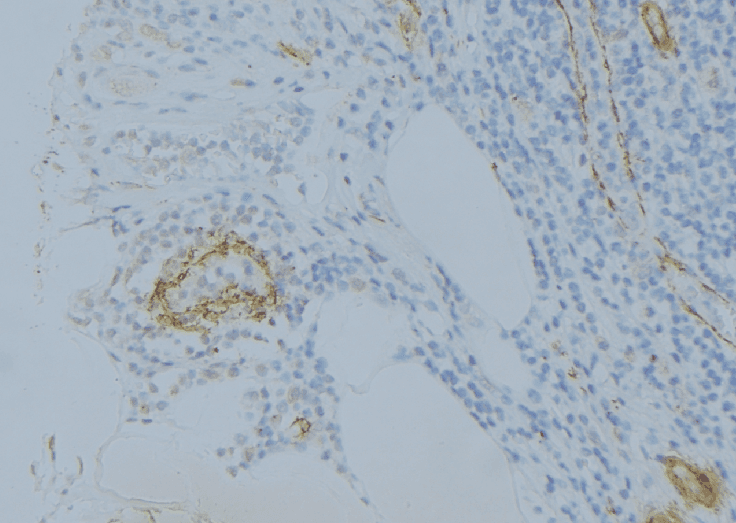 Complement C1s Antibody