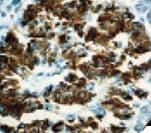 Monoclonal Mouse anti-Human Insulin Antibody (Ready-to-Use, IHC)