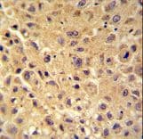 Polyclonal Rabbit anti-Human WBSCR27 Antibody (aa5-34, IHC, WB)