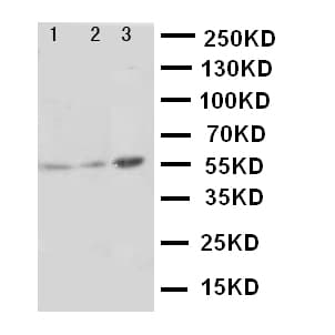 PKM / Pyruvate Kinase, Muscle Antibody (aa77-91)