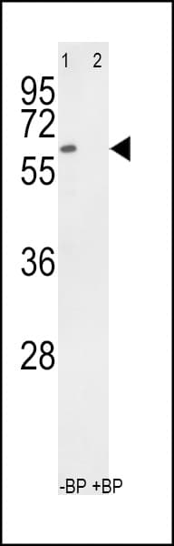 Polyclonal Rabbit anti-Human RYK Antibody (aa561-591, IHC, WB)
