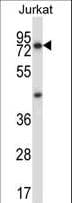 MCOLN1 / Mucolipin 1 Antibody (aa531-560)