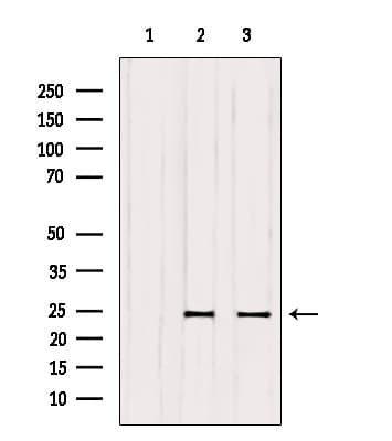 Polyclonal Rabbit anti-Human RAB6A / RAB6 Antibody (IF, WB)