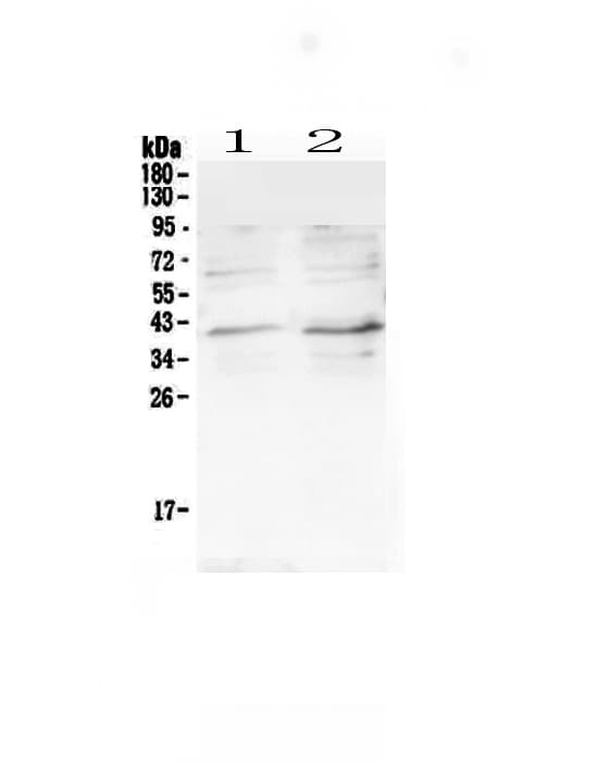 Polyclonal Rabbit anti-Human CCR5 Antibody (WB)