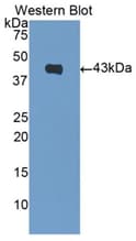 NPPB / BNP Antibody (aa27-121)
