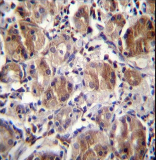 CTDNEP1 / DULLARD Antibody (aa131-160)